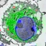 CLEM-Aufnahme (Confocal Laser and Electron Microscopy) einer dendritischen Zelle: Mit dieser speziellen Mikroskopietechnik konnten die Forscher Sec61 (kleine schwarze Pünktchen) in den rotgefärbte Endosomen ("Tüten") sichtbar machen. (c) AG Burgdorf
