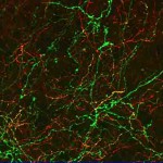 Das Bild zeigt die Verknüpfungen, die von den Dopamin produzierenden Zellen in den präfrontalen Cortex reichen (rot). Grün eingefärbt sind Zellen, die mit einem lichtempfindlichen Protein markiert wurden. © Foto: Life & Brain